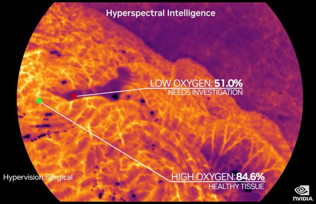 65cf3c0a9be9a5b998b5eb85_HVS1 King's surgical AI spin-out Hypervision Surgical secures £6.5M seed investment