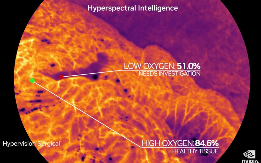 King’s surgical AI spin-out Hypervision Surgical secures £6.5M seed investment